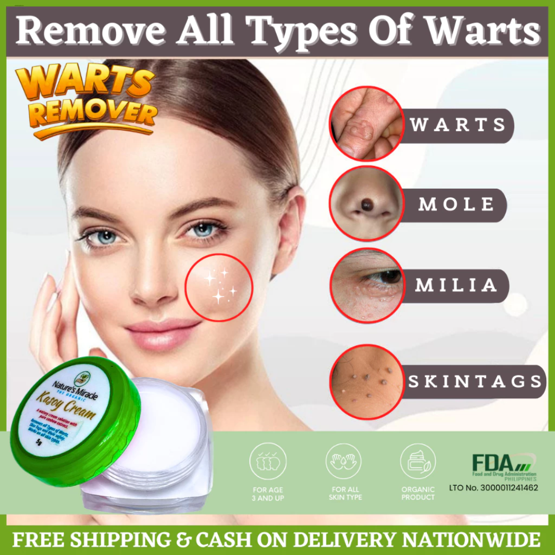 Miracle Kasoy Cream Original Wart Removal Skin